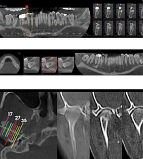 Stratigrafia